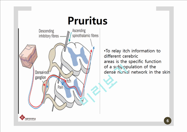 Pathophysiology and therapy of pruritus in allergic and atopic diseases   (6 )